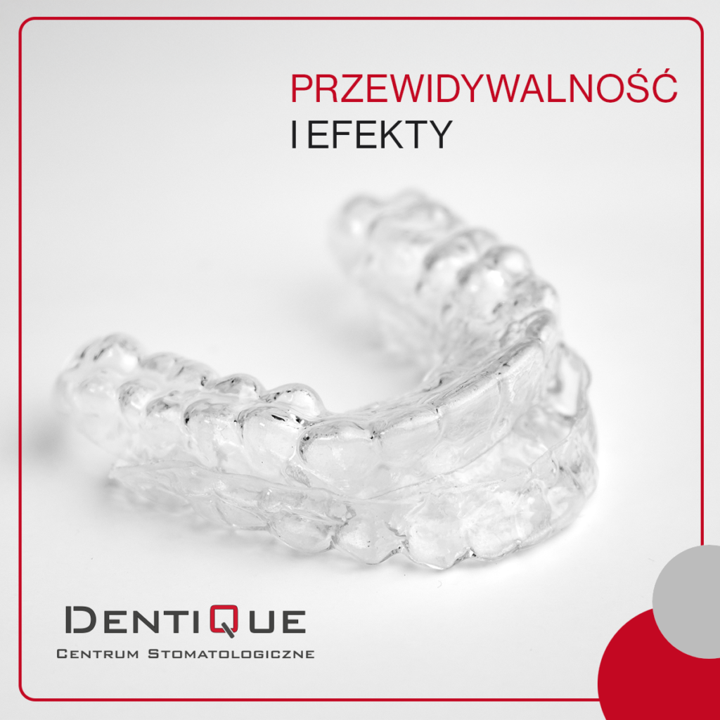 DentiQue Stomatologia Wrocław Dentique Przewidywalnosc i Efekty Kwadrat