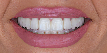 DentiQue Stomatologia Wrocław 1129468364 3