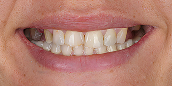 DentiQue Stomatologia Wrocław 1129468364 4