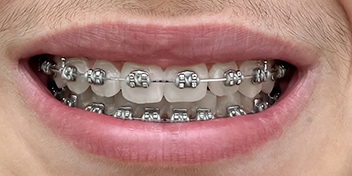 DentiQue Stomatologia Wrocław 553161331 3