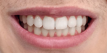 DentiQue Stomatologia Wrocław 553161331 4