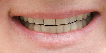 DentiQue Stomatologia Wrocław 931700761 2