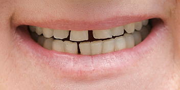 DentiQue Stomatologia Wrocław 931700761 3