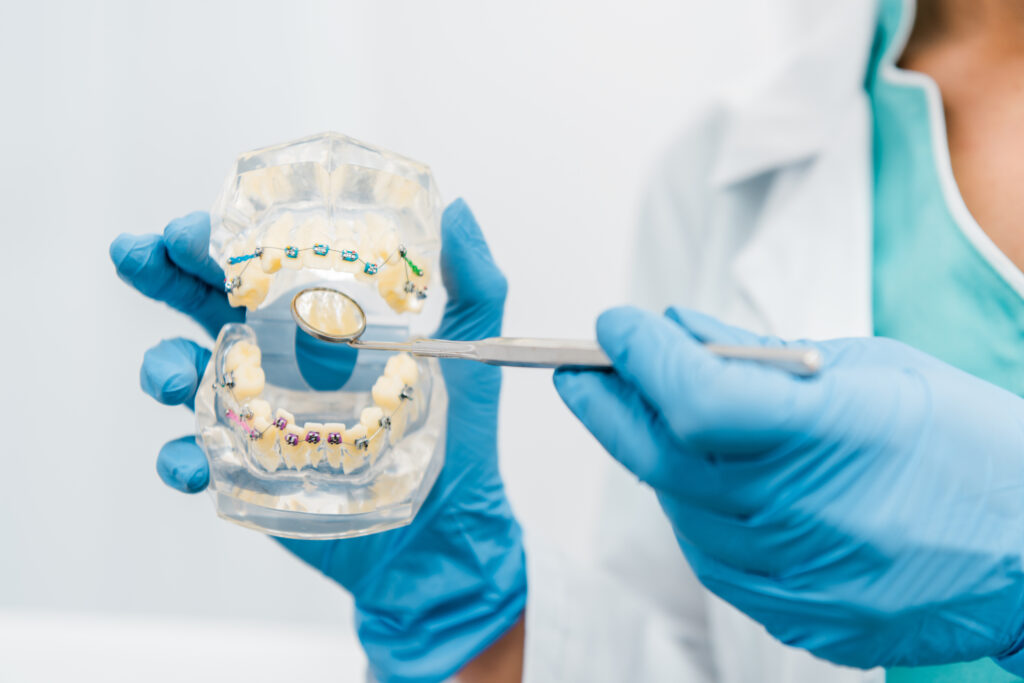 DentiQue Stomatologia Wrocław cropped view of dental jaw model in hands of stoma 2024 11 18 09 35 32 utc